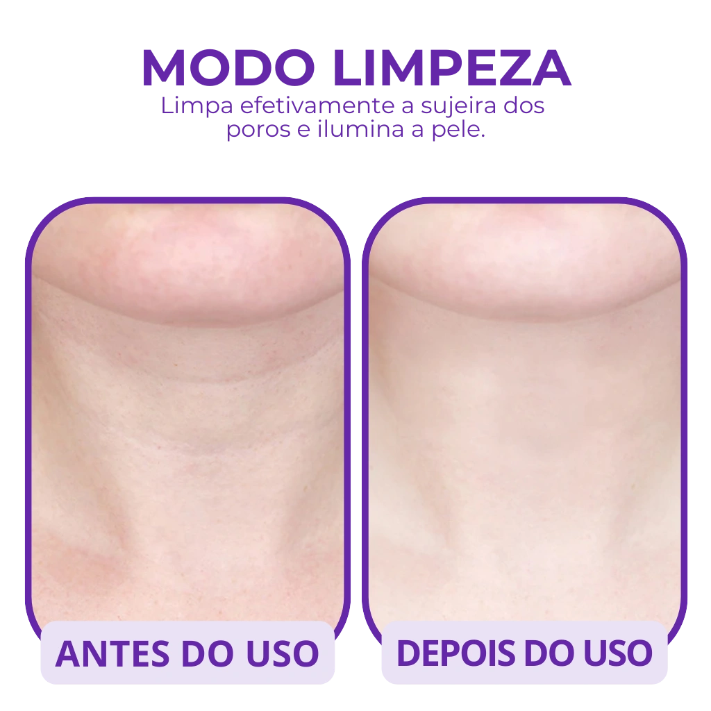 Massageador Facial LED - Rejuvenesça a Pele em Minutos!
