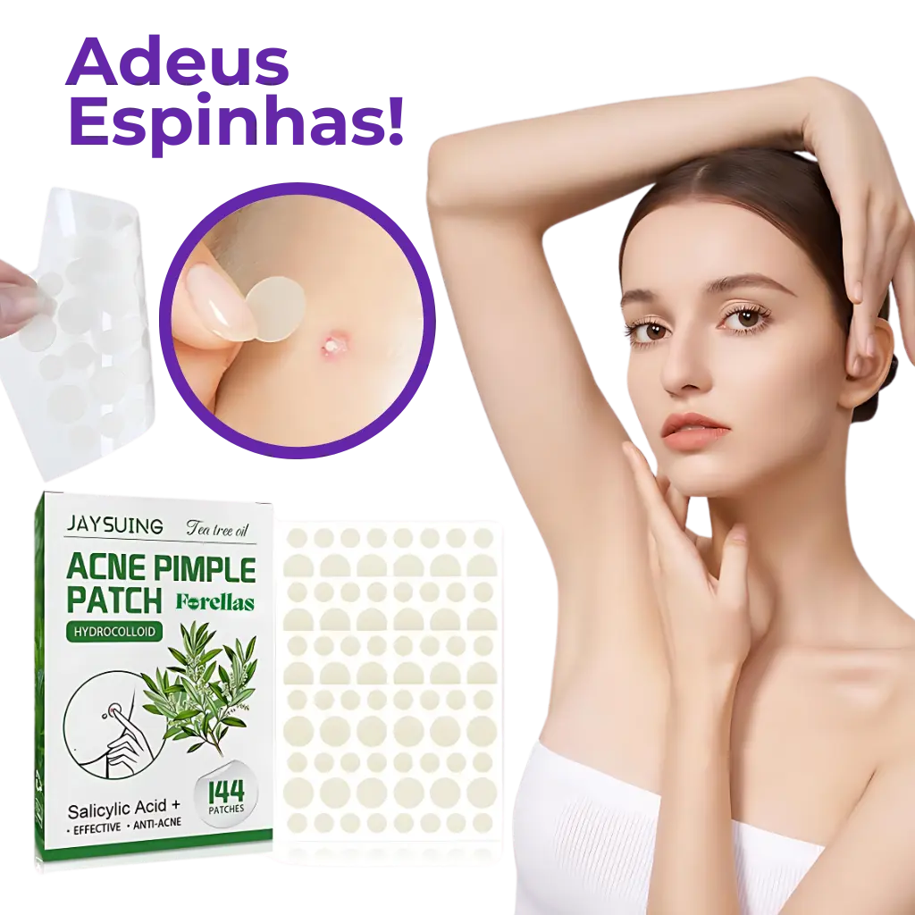 Adesivo Antiacne - Elimine Espinhas sem Marcas em 1 Dia!