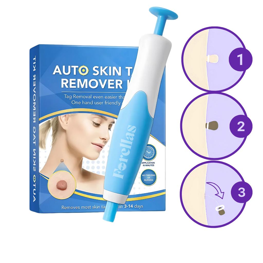 Removedor de Verrugas – Caneta para Remoção Permanente e Segura!