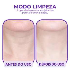 Massageador Facial LED - Rejuvenesça a Pele em Minutos!