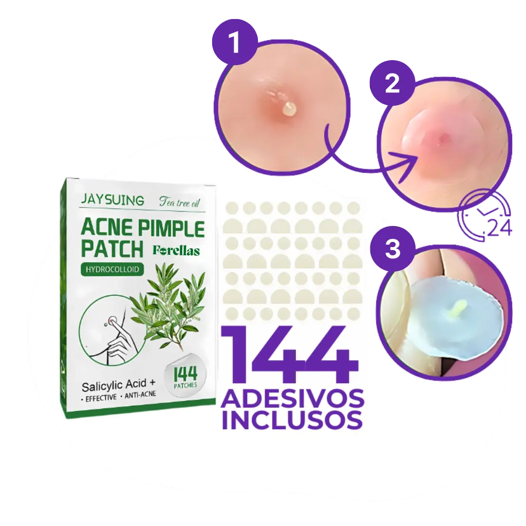 Adesivo para Espinhas – Transparente, Discreto e Eficaz em 24 Horas!