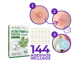 Adesivo Antiacne - Elimine Espinhas sem Marcas em 1 Dia!