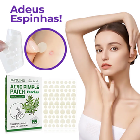Adesivo Antiacne - Elimine Espinhas sem Marcas em 1 Dia!